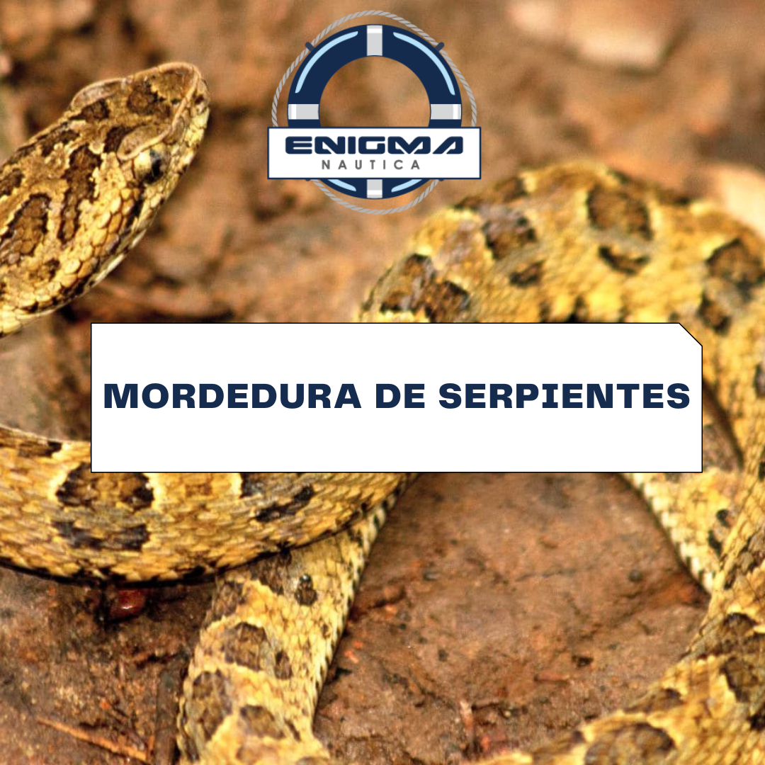 Mordedura de serpientes - Ofidismo. Mordedura de Serpientes venenosas
